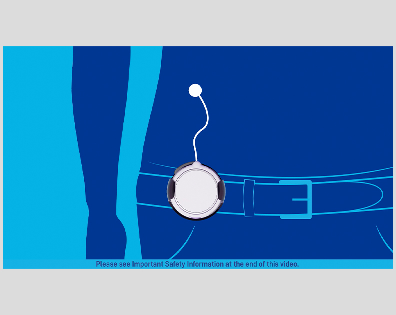 Remunity HCP and Patient Video: Remunity User Guide—Connecting Your First Cassette thumbnail