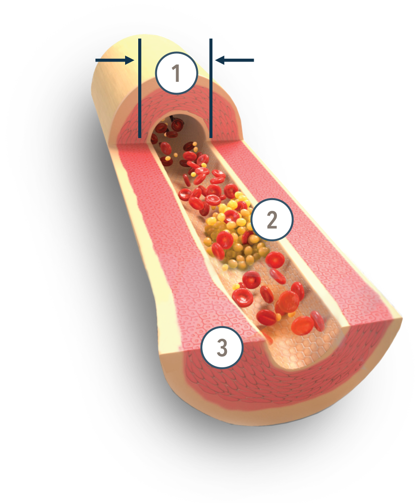 Treprostinil mechanism of action